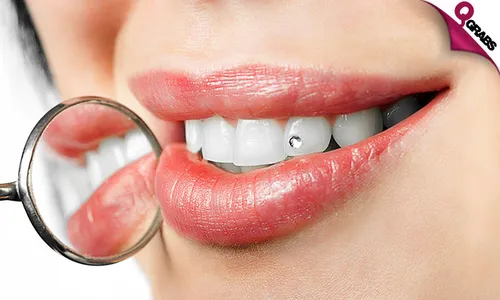 Dental Jewelry & Tooth Filling with X-Ray + Consultation!